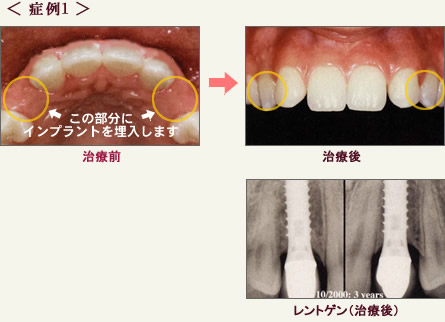 症例1