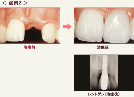 症例2