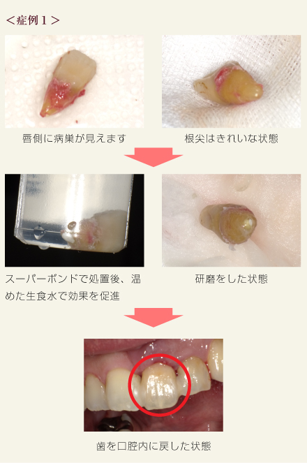 症例1
