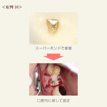症例10