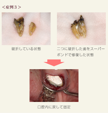 症例3
