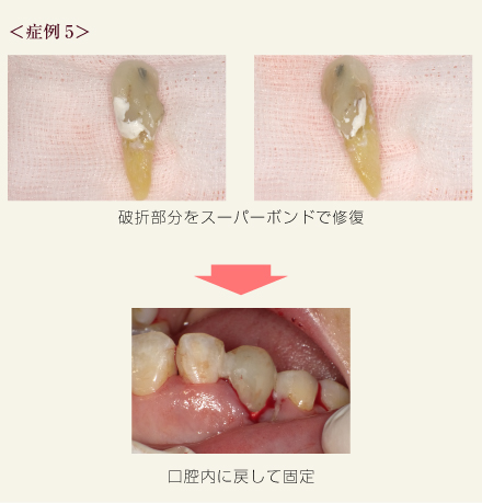 症例5