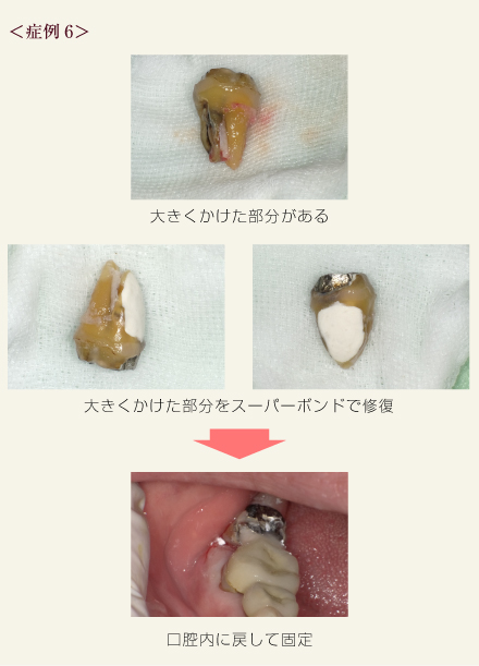 症例6