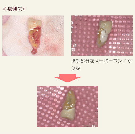 症例7