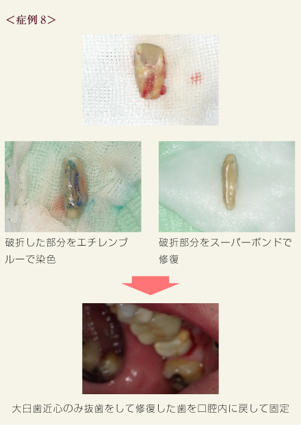 症例8