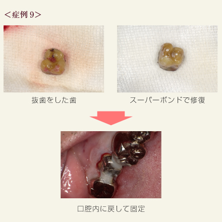 症例9